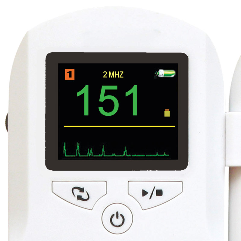 康泰超声多普勒胎儿心率仪sonolinec胎心听诊器