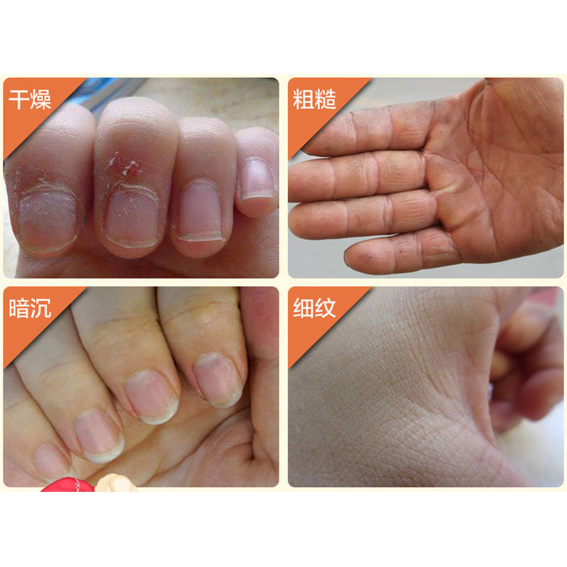 韦香儿滋润护手霜补水防干裂护手霜冬季手部护理保湿手霜平价1支